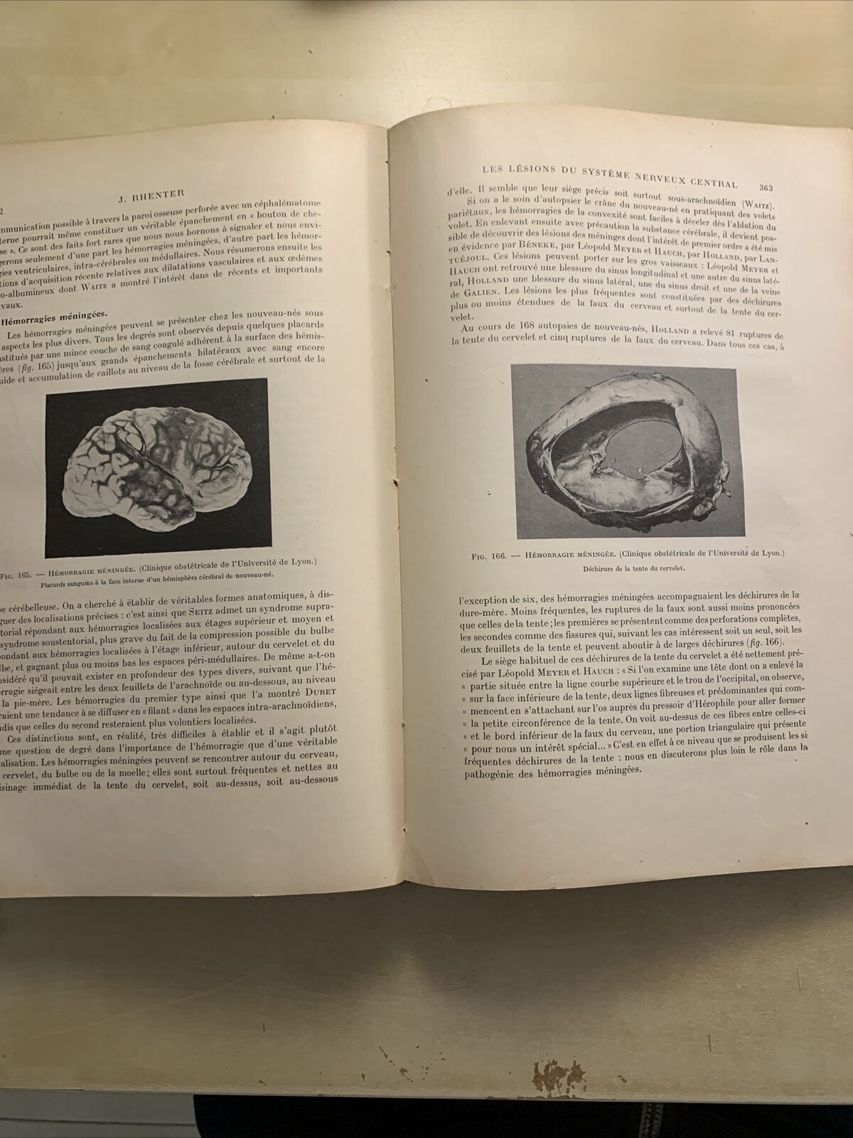 La pratique de l'art des accouchements V. A. Brindeau, Rhenter, Balthazard 1928