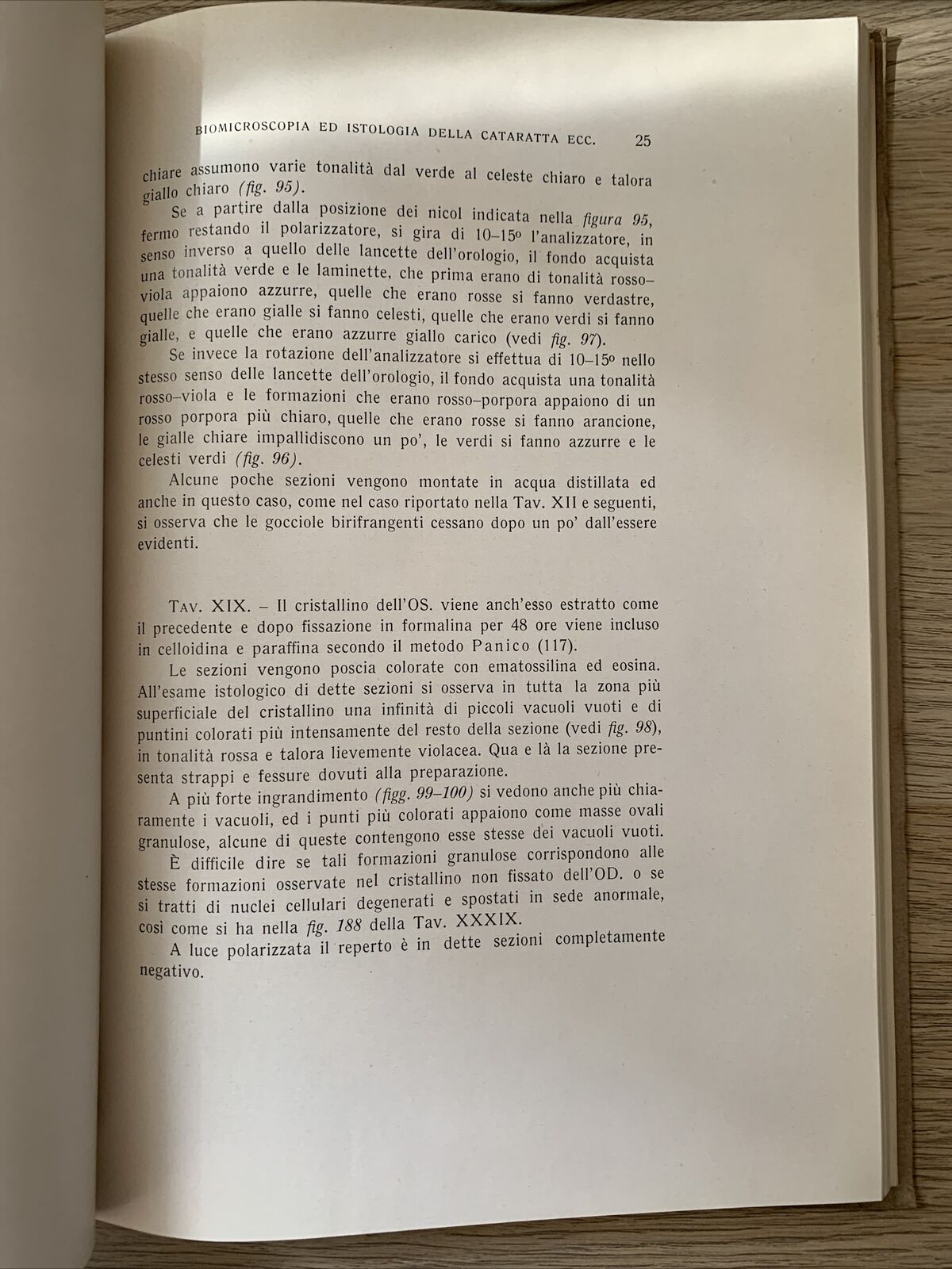 BIOMICROSCOPIA ED ISTOLOGIA DELLA CATARATTA A LUCE POLARIZZATA - Strampelli 1934
