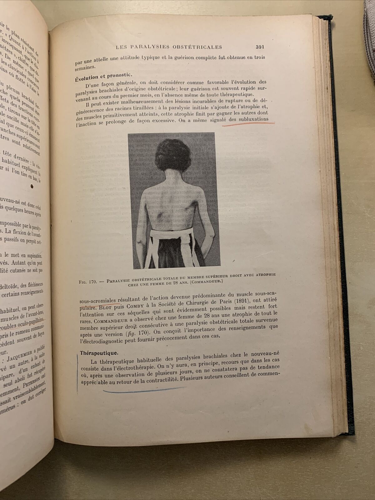 La pratique de l'art des accouchements V. A. Brindeau, Rhenter, Balthazard 1928