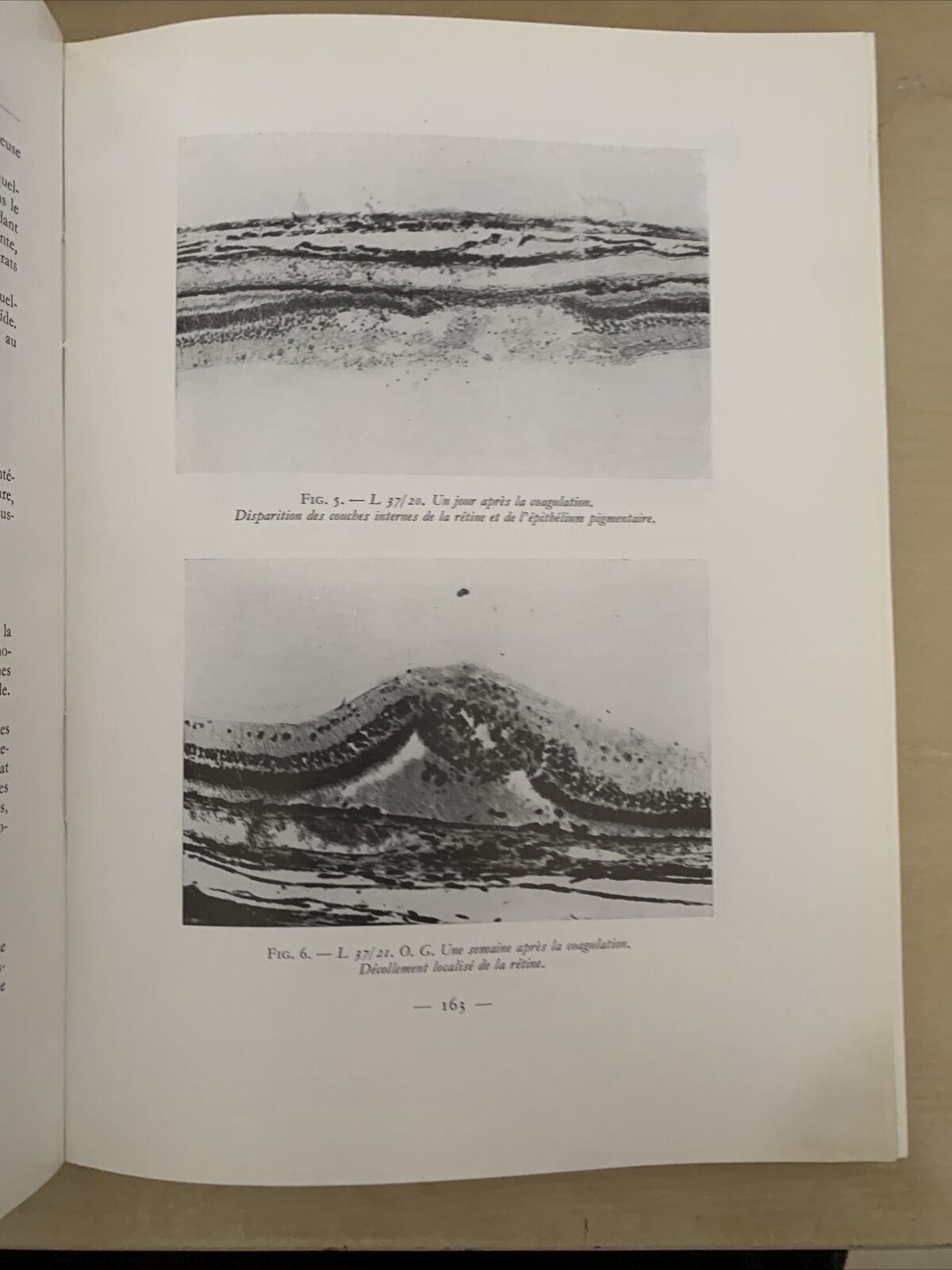 TRAVAUX D'OPHTALMOLOGIE MODERNE - Mawas Jacques - Masson et Cie 1966 #