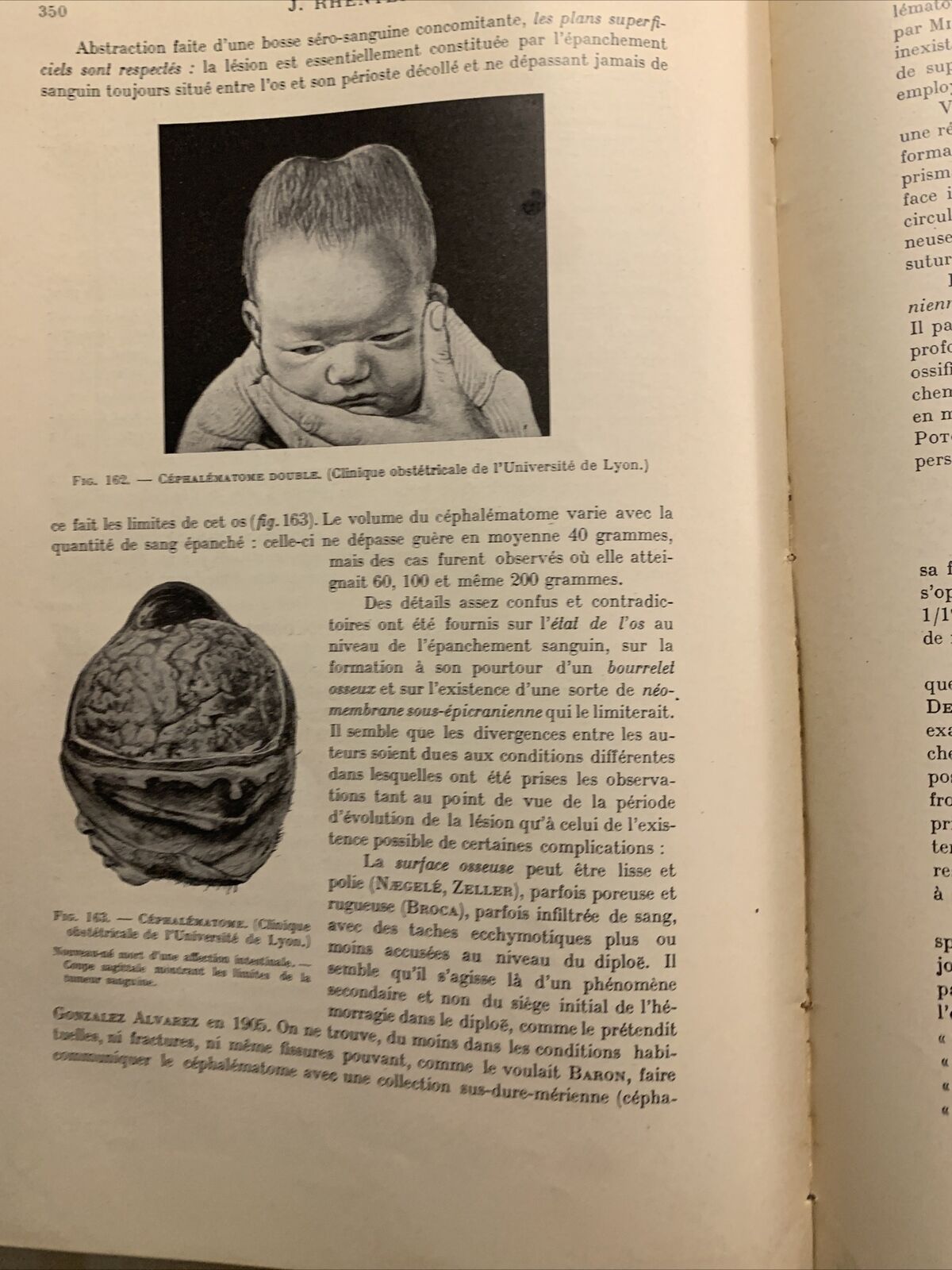 La pratique de l'art des accouchements V. A. Brindeau, Rhenter, Balthazard 1928