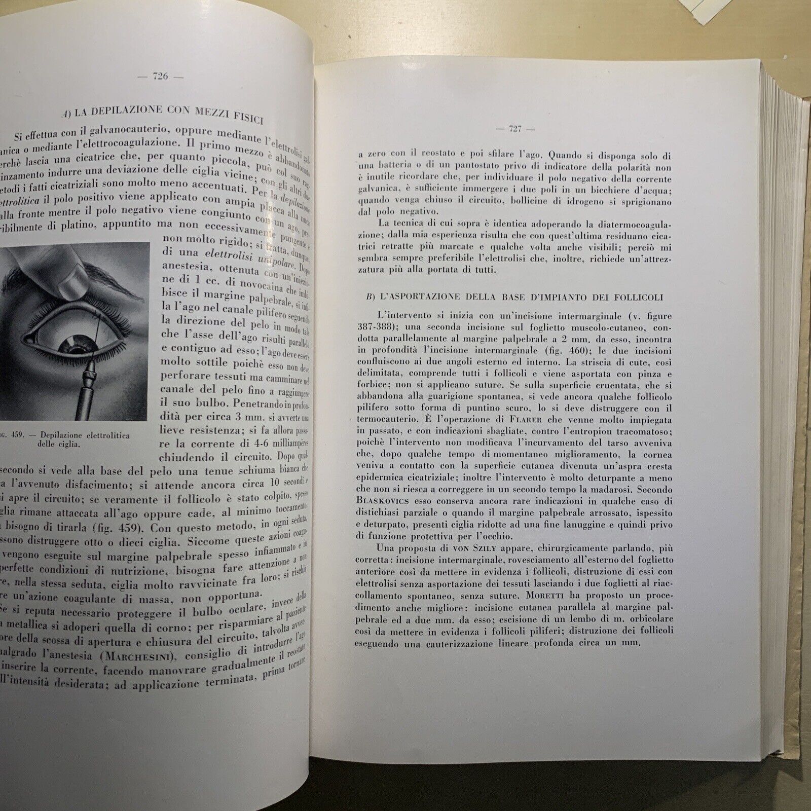 CHIRURGIA DELL'APPARATO OCULARE Volume secondo. E. LEONARDI. ARTE DELLA STAMPA #