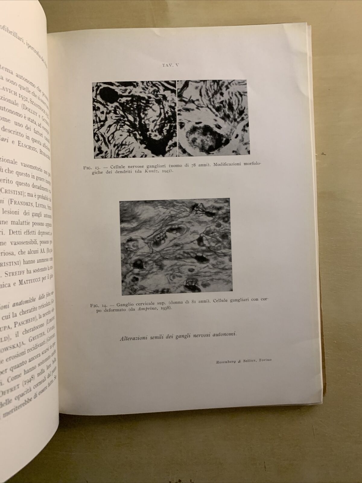 IL SISTEMA NERVOSO AUTONOMO NELLA FISIOPATOLOGIA OCULARE - MATTEUCCI. Rosenberg#