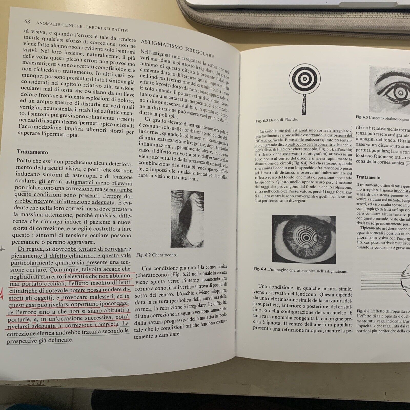 PRATICA DELLA REFRAZIONE DI DUKE ELDER - David Abrams, Piccin 1988 #